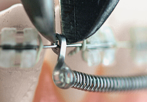 Huckepackfeder Starterset, 1 Stk. je Größe