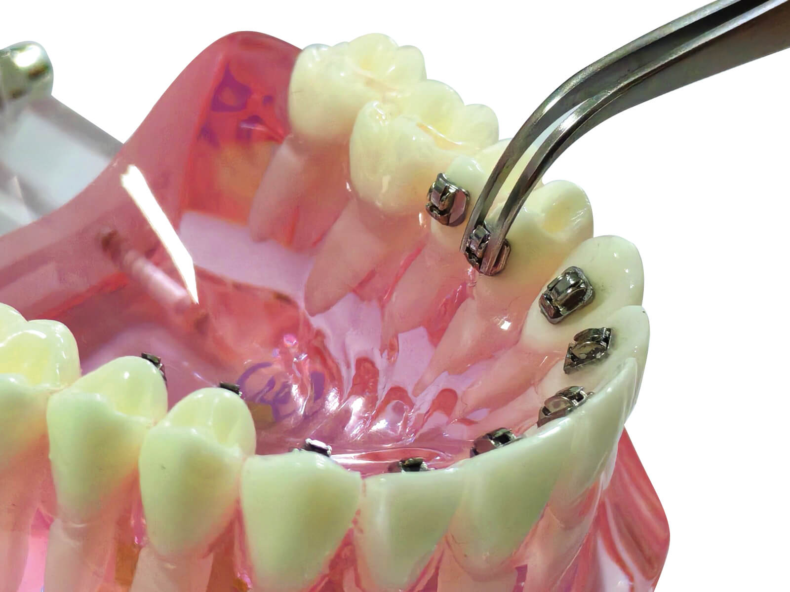 Aplos - SL Mini-Tube-System, 0.017" x 0.017"