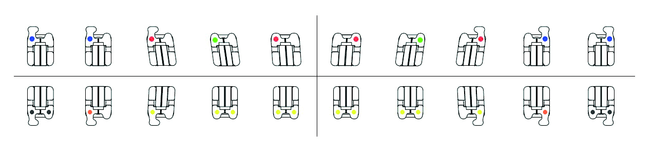 CePassTM Pro Brackets, single