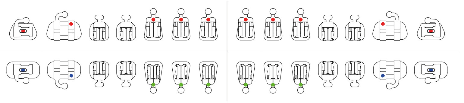 LinPass - Lingual Self-Ligating Brackets