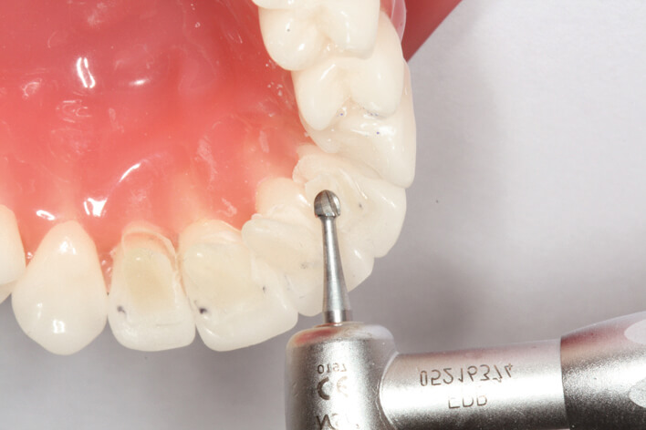 Tiger Mini Mold (mit Orthohalter)