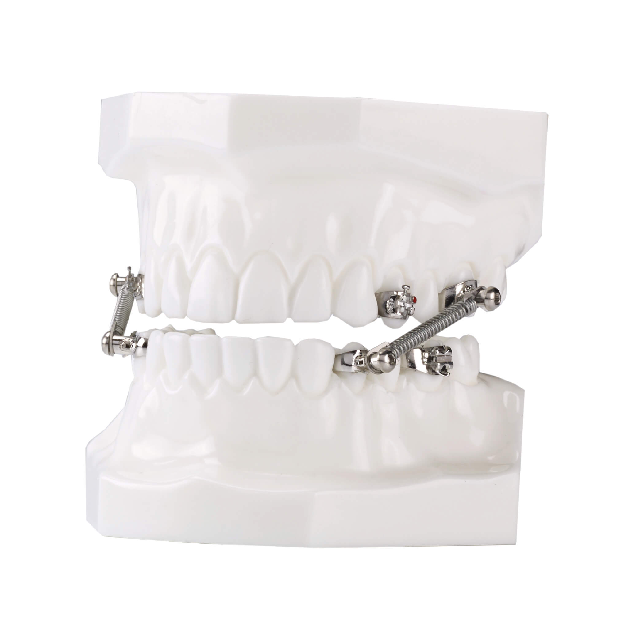 CS5 Twist Lock, 5-Patienten Kit (7 mm)