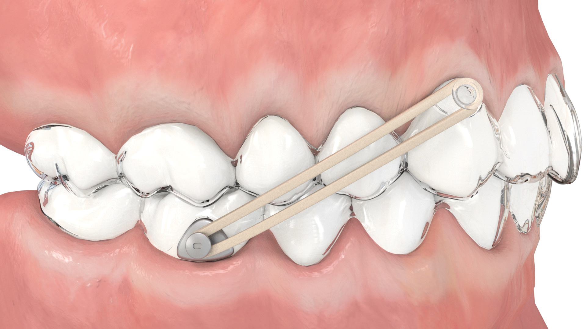 Aligner Buttons, transparent