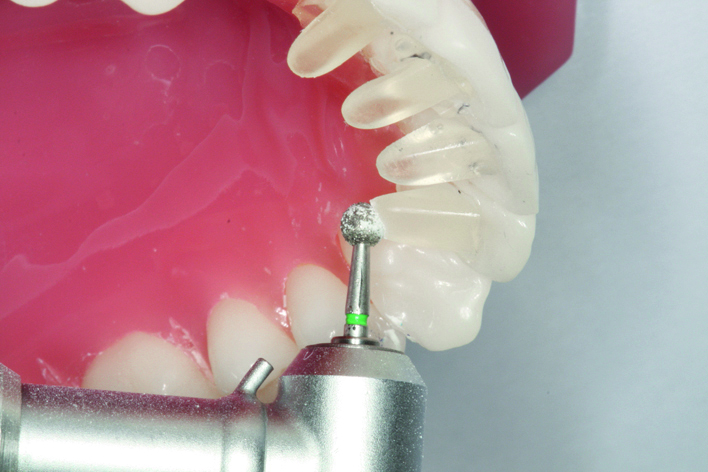 Tiger Mini Mold (mit Orthohalter)