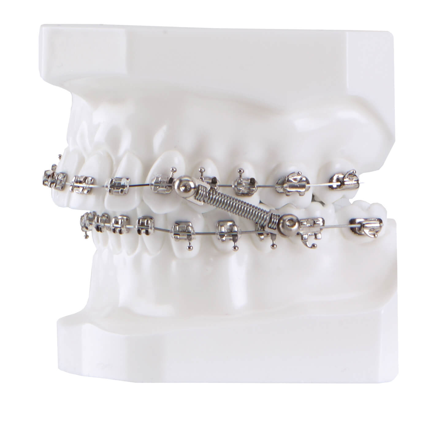 CS5 Twist Lock, 5-Patienten Kit (7 mm)