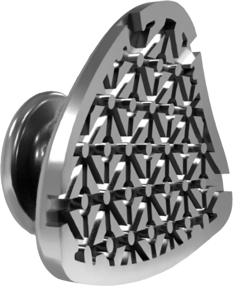 Aligner Buttons, Metall