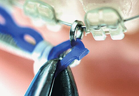 Huckepackfeder Starterset, 1 Stk. je Größe