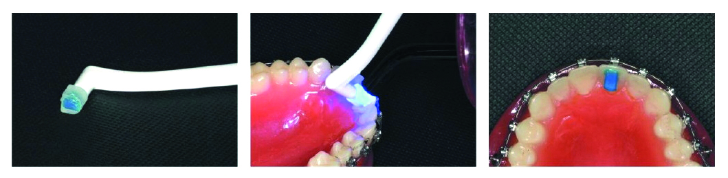 Band Cement "Blue" Set