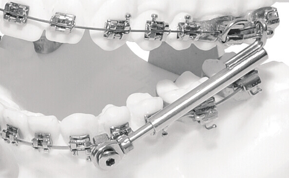 SUS³ - Set with installation key (starter set)