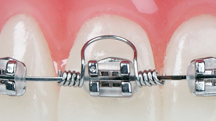 GTS - große Feder (5 Stück/Pack)